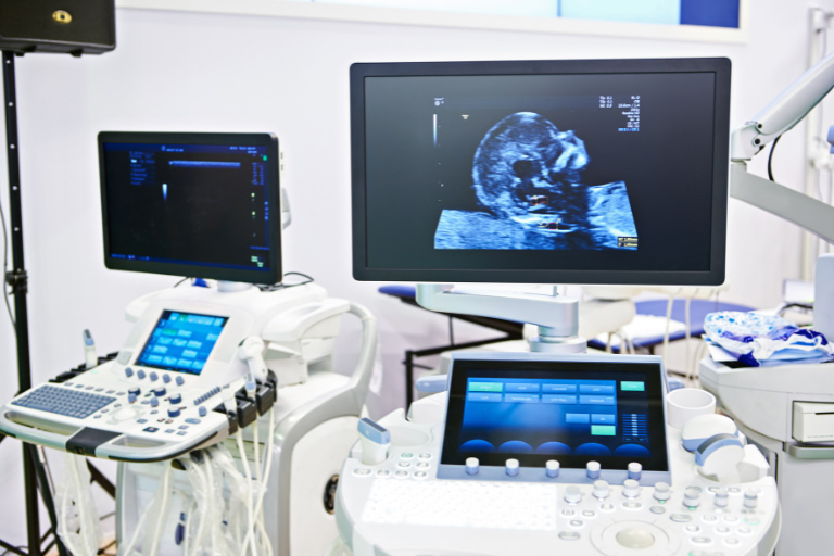 Zwei Ultraschallgeräte in einem Raum mit verschiedenem medizinischem Equipment.